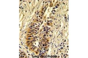 Immunohistochemistry (IHC) image for anti-Transaldolase 1 (TALDO1) antibody (ABIN3002744) (TALDO1 抗体)