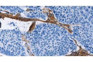 Immunohistochemistry (Paraffin-embedded Sections) (IHC (p)) image for anti-Collagen, Type III, alpha 1 (COL3A1) antibody (ABIN7234918)