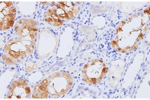Immunohistochemistry of paraffin-embedded Rat kidney using Pck1 Polyclonal Antibody at dilution of 1:100 (PCK1 抗体)