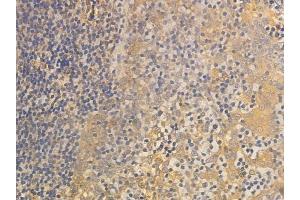 ABIN6257396 and ABIN6275332 at 1/100 staining human normal tonsil tissue by IHC-P.