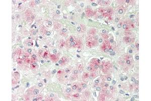 Human Adrenal: Formalin-Fixed, Paraffin-Embedded (FFPE) (SERPINA5 抗体)
