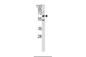 Western blot analysis of CEACAM antibody in HepG2 cell line lysates (35ug/lane) (CEACAM5 抗体  (N-Term))