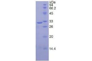SDS-PAGE of Protein Standard from the Kit (Highly purified E. (CAPN1 ELISA 试剂盒)