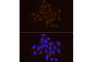 Immunofluorescence analysis of HeLa cells using USO1 Rabbit mAb (ABIN7271234) at dilution of 1:100 (40x lens). (USO1 抗体)