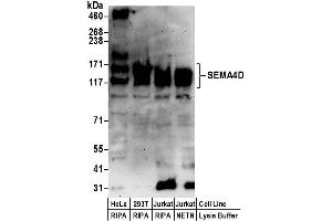 Western Blotting (WB) image for anti-Sema Domain, Immunoglobulin Domain (Ig), Transmembrane Domain (TM) and Short Cytoplasmic Domain, (Semaphorin) 4D (SEMA4D) (AA 812-862) antibody (ABIN7450715)