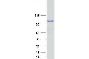 Western Blotting (WB) image for Sec23 Homolog B (SEC23B) (Transcript Variant 3) protein (Myc-DYKDDDDK Tag) (ABIN2731572)