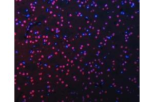 IF analysis of RBM22 using anti-RBM22 antibody (ABIN7600268).