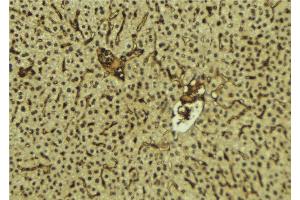 ABIN6278360 at 1/100 staining Mouse liver tissue by IHC-P. (FUS 抗体  (C-Term))