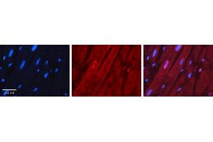 Rabbit Anti-NKX2-5 Antibody Catalog Number: ARP31575_P050 Formalin Fixed Paraffin Embedded Tissue: Human Heart Muscle Tissue Observed Staining: Nucleus Primary Antibody Concentration: 1:100 Other Working Concentrations: 1:600 Secondary Antibody: Donkey anti-Rabbit-Cy3 Secondary Antibody Concentration: 1:200 Magnification: 20X Exposure Time: 0. (NK2 Homeobox 5 抗体  (N-Term))