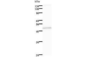 Western Blotting (WB) image for anti-serine/threonine Kinase 38 Like (STK38L) antibody (ABIN931250) (STK38L 抗体)