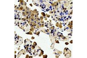 Immunohistochemistry (IHC) image for anti-B-Cell CLL/lymphoma 2 (BCL2) (pSer56) antibody (ABIN7303946)