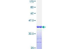 Image no. 1 for Interleukin 1, beta (IL1B) (AA 170-269) protein (GST tag) (ABIN1307742) (IL-1 beta Protein (AA 170-269) (GST tag))