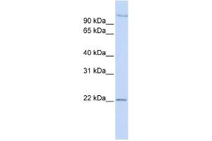 PDS5B antibody used at 1 ug/ml to detect target protein. (PDS5B 抗体)