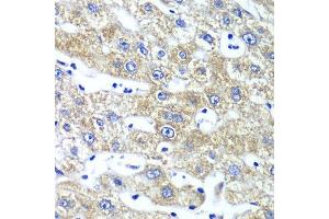 Immunohistochemistry of paraffin-embedded human liver injury using QARS antibody.