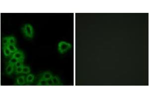 Immunofluorescence analysis of MCF7 cells, using PE2R4 Antibody. (PTGER4 抗体  (AA 321-370))