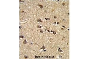 Immunohistochemistry (IHC) image for anti-Ras Interacting Protein 1 (RASIP1) antibody (ABIN3002848) (RASIP1 抗体)