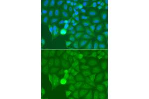 Immunofluorescence analysis of A549 cells using IRAK2 antibody. (IRAK2 抗体)