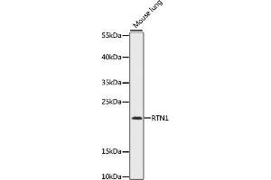 Western blot analysis of extracts of mouse lung, using RTN1 antibody (ABIN7269928) at 1:1000 dilution. (Reticulon 1 抗体  (AA 80-340))