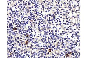 Immunohistochemistry analysis of paraffin-embedded rat lymph node using BAG2 Polyclonal Antibody at dilution of 1:400. (BAG2 抗体)