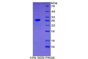 SDS-PAGE analysis of Mouse CLEC10A Protein. (CLEC10A 蛋白)