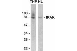 Western blot analysis of IRAK in THP-1 (THP) and HeLa (HL) whole cell lysates with AP30438PU-N IRAK antibody at 1/2000 dilution.