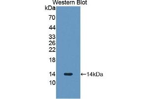 Detection of Recombinant PLOD3, Human using Polyclonal Antibody to Procollagen Lysine-2-Oxoglutarate-5-Dioxygenase 3 (PLOD3) (PLOD3 抗体  (AA 647-738))