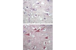 Immunohistochemical analysis of TUBB2A in paraffin-embedded formalin-fixed human brain tissue using an isotype control (top) and TUBB2A polyclonal antibody  (bottom) at 5 ug/mL . (TUBB2A 抗体  (AA 417-435))