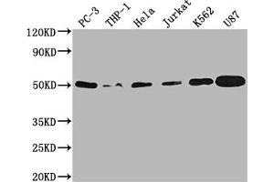 Western Blotting (WB) image for anti-Protein tyrosine Phosphatase, Non-Receptor Type 1 (PTPN1) antibody (ABIN7127784)