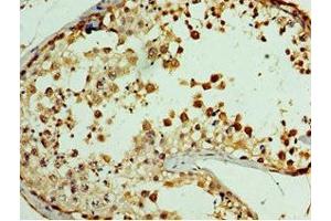 Immunohistochemistry (IHC) image for anti-G Protein-Coupled Receptor, Family C, Group 5, Member A (GPRC5A) (AA 258-357) antibody (ABIN7167823)