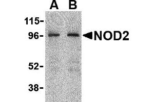 Western Blotting (WB) image for anti-Nucleotide-Binding Oligomerization Domain Containing 2 (NOD2) (C-Term) antibody (ABIN1030547)