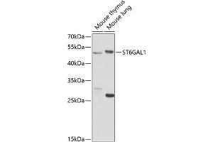 Western blot analysis of extracts of various cell lines, using ST6G antibody (ABIN6130083, ABIN6148536, ABIN6148538 and ABIN6221427) at 1:1000 dilution. (ST6GAL1 抗体  (AA 27-200))