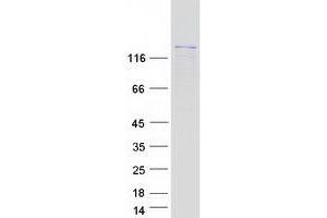 Western Blotting (WB) image for Breakpoint Cluster Region (BCR) (Transcript Variant 2) protein (Myc-DYKDDDDK Tag) (ABIN2715211)