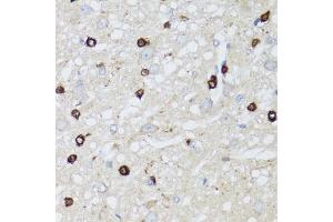 Immunohistochemistry of paraffin-embedded rat brain using MIP antibody (ABIN5971491) at dilution of 1/100 (40x lens). (MIP 抗体)