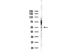 Western blot analysis of lysates from Hela cells(starvation,24h treatment), using GCN Antibody at 1/1000 dilution.