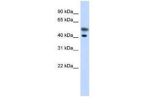WB Suggested Anti-TMOD2 Antibody Titration: 0. (TMOD2 抗体  (N-Term))