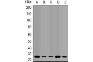 Western blot analysis of QDPR expression in HL60 (A), SW620 (B), mouse liver (C), mouse brain (D), rat liver (E) whole cell lysates. (QDPR 抗体)