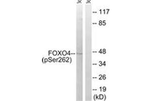 Western blot analysis of extracts from Jurkat cells treated with starved 24h, using FOXO4 (Phospho-Ser262) Antibody. (FOXO4 抗体  (pSer262))