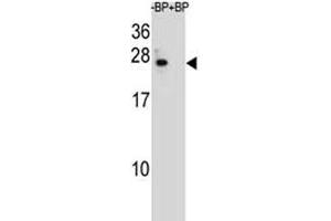 Image no. 2 for anti-B-Cell CLL/lymphoma 2 (BCL2) (AA 87-116) antibody (ABIN3030095)