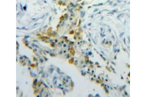 Used in DAB staining on fromalin fixed paraffin-embedded lung tissue (FABP5 抗体  (AA 1-135))