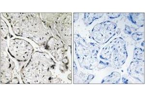 Immunohistochemistry analysis of paraffin-embedded human placenta tissue, using SAR1B Antibody. (SAR1B 抗体  (AA 111-160))