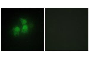 Immunofluorescence analysis of HepG2 cells, using IPPK antibody. (IPPK 抗体  (N-Term))