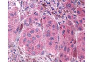 Immunohistochemistry (IHC) image for anti-Prostaglandin F Receptor (FP) (PTGFR) (Extracellular Domain) antibody (ABIN1049263)