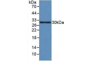 Detection of Recombinant IGFBP1, Human using Monoclonal Antibody to Insulin Like Growth Factor Binding Protein 1 (IGFBP1) (IGFBPI 抗体  (AA 36-235))
