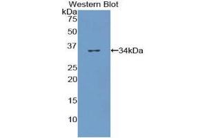 Western Blotting (WB) image for anti-Collagen, Type VII (COL7) (AA 190-472) antibody (ABIN1175574) (COL7 抗体  (AA 190-472))