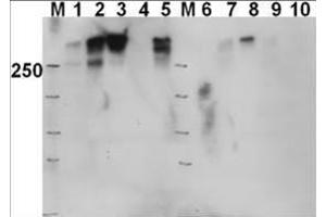 Western blot using  Affinity Purified anti-DNAPKcs antibody shows detection of a 460 kDa band corresponding to human DNAPKcs in various preparations. (PRKDC 抗体  (pThr2609))