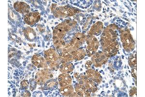 BHMT antibody was used for immunohistochemistry at a concentration of 4-8 ug/ml. (BHMT 抗体  (C-Term))