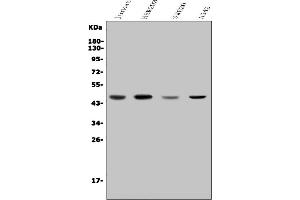 Western blot analysis of CDC123 using anti-CDC123 antibody (ABIN7599284).