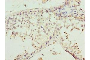 Immunohistochemistry of paraffin-embedded human testis tissue using ABIN7160187 at dilution of 1:100 (MMD2 抗体  (AA 1-38))