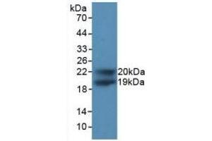 Detection of Recombinant CDKN1A, Human using Polyclonal Antibody to Cyclin Dependent Kinase Inhibitor 1A (CDKN1A) (p21 抗体  (AA 1-164))