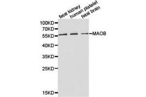 Western Blotting (WB) image for anti-Monoamine Oxidase B (MAOB) antibody (ABIN1873594) (Monoamine Oxidase B 抗体)